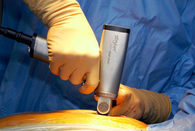 54cfd02b1c27c_-_heartsurgery-02-0611-xln